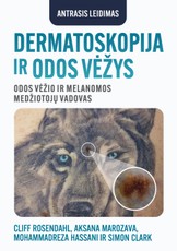 Dermatoskopija ir odos vėžys
