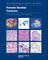 Female Genital Tumours
