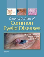 Diagnostic Atlas of Common Eyelid Diseases