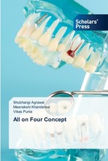 All on Four Concept
