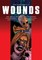 Wounds