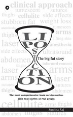 Liposuction - The Big Fat Story