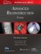 Advanced Reconstruction Knee