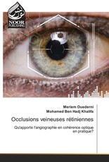 Occlusions veineuses rÃ©tiniennes
