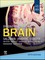 Diagnostic Imaging: Brain,