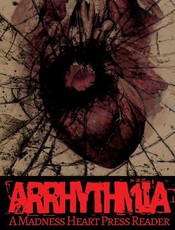 Arrhythmia