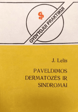 Paveldimos dermatozės ir sindromai