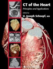 CT of the Heart