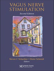 Vagus Nerve Stimulation
