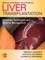 Liver Transplantation: Operative Techniques and Medical Management