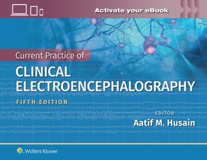 Ebersole's Current Practice of Clinical Electroencephalography