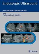 Endoscopic Ultrasound