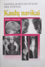 Kaulų navikai. Klinika ir diagnostika