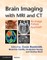 Brain Imaging with MRI and CT