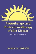 Phototherapy and Photochemotherapy for Skin Disease