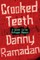 Crooked Teeth