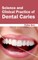 Science and Clinical Practice of Dental Caries