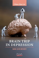 Brain Trip in Depression