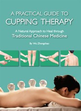 Practical Guide to Cupping Therapy