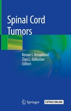 Spinal Cord Tumors