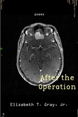 After the Operation