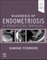 Diagnosis of Endometriosis