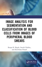 Image Analysis for Segmentation and Classification of Blood Cells from Images of Peripheral Blood Smears