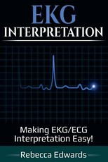 EKG Interpretation