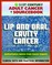 21st Century Adult Cancer Sourcebook: Lip and Oral Cavity Cancer - Clinical Data for Patients, Families, and Physicians