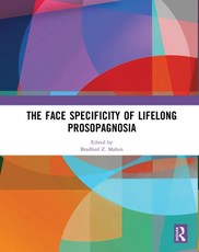 The Face Specificity of Lifelong Prosopagnosia