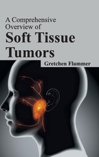 Comprehensive Overview of Soft Tissue Tumors