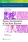 Wake, L: Biopsy Interpretation of the Bone Marrow