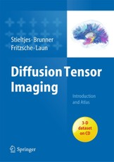 Diffusion Tensor Imaging