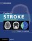 Caplan's Stroke