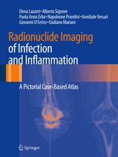 Radionuclide Imaging of Infection and Inflammation