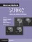 More Case Studies in Stroke