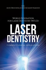Laser Dentistry