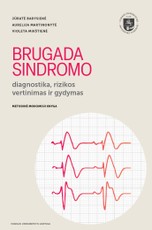 Brugada sindromo diagnostika, rizikos vertinimas ir gydymas