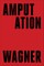 Amputation