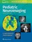 Pediatric Neuroimaging