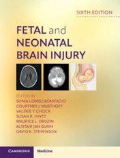 Fetal and Neonatal Brain Injury