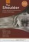 The Shoulder