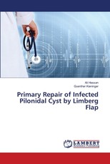 Primary Repair of Infected Pilonidal Cyst by Limberg Flap