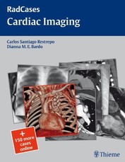 Cardiac Imaging