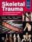 Skeletal Trauma
