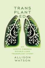 Watson, A: Transplanted