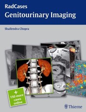 Genitourinary Imaging