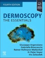 Dermoscopy: The Essentials