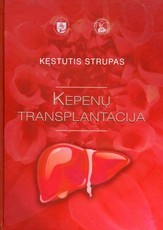 Kepenų transplantacija