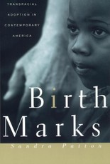 Birthmarks